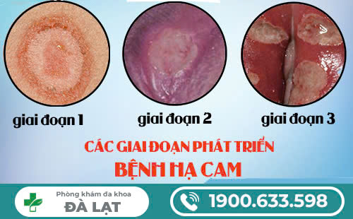 Hình ảnh minh họa